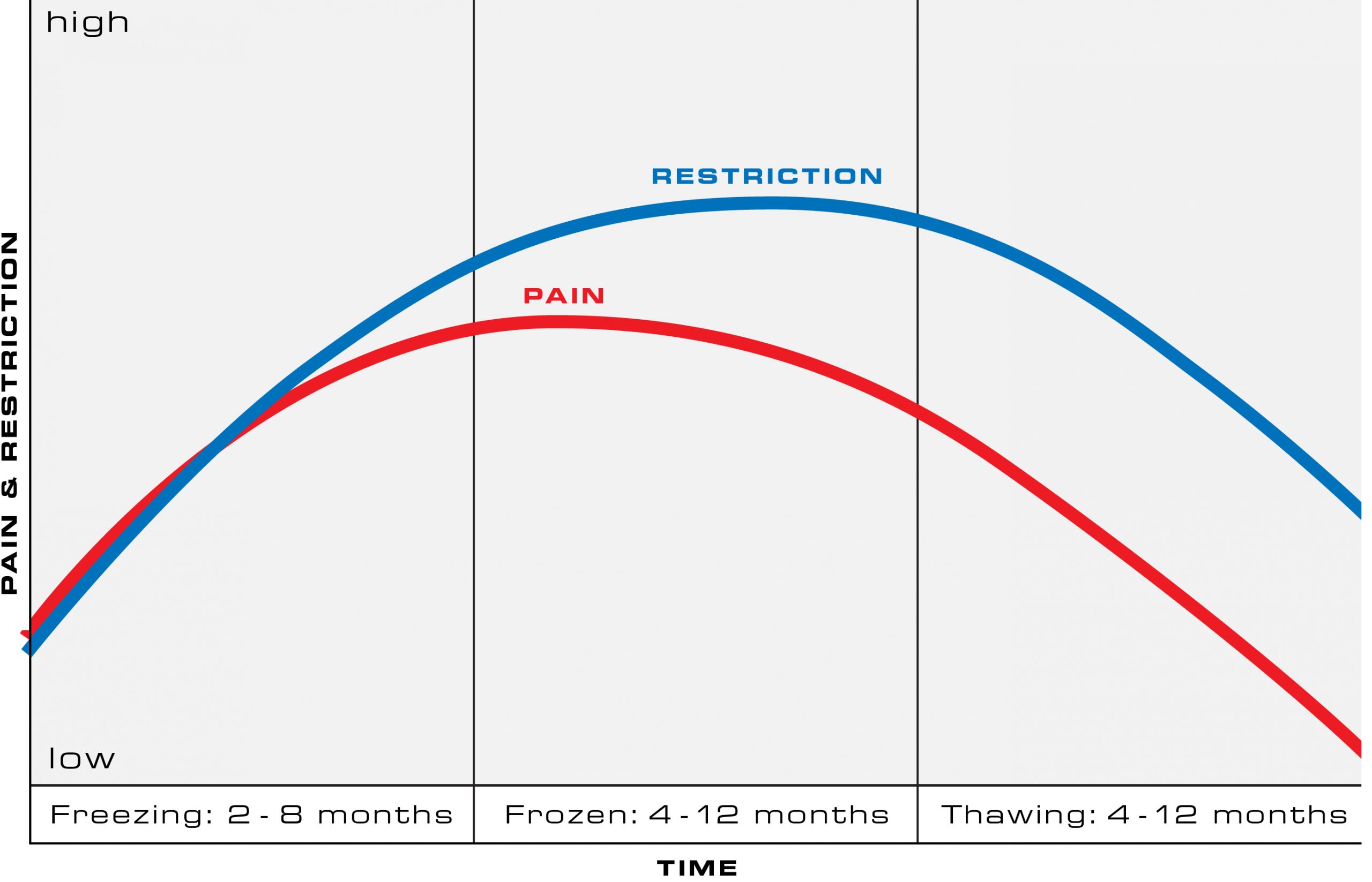 Frozen Shoulder, The phases of Frozen Shoulder
